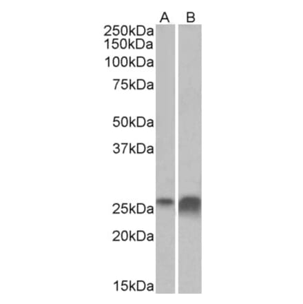 Western Blot - Anti-Apo-D Antibody (A85163) - Antibodies.com