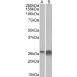 Western Blot - Anti-Apo-D Antibody (A85163) - Antibodies.com