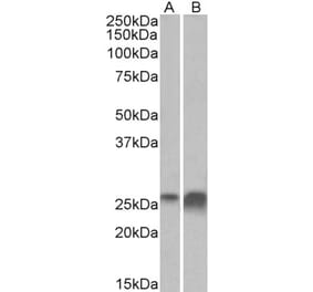 Western Blot - Anti-APOD Antibody (A85163) - Antibodies.com
