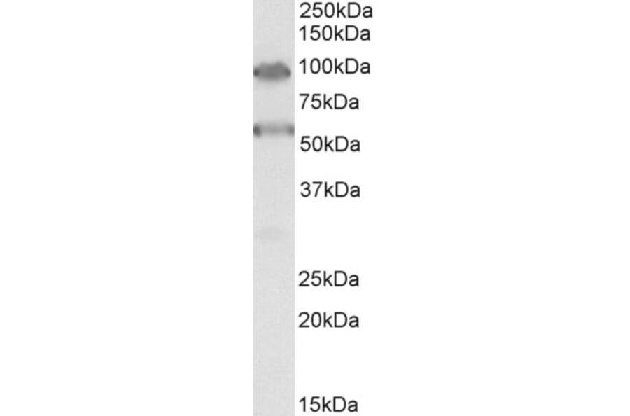 Western Blot - Anti-TBC1D9 Antibody (A85165) - Antibodies.com