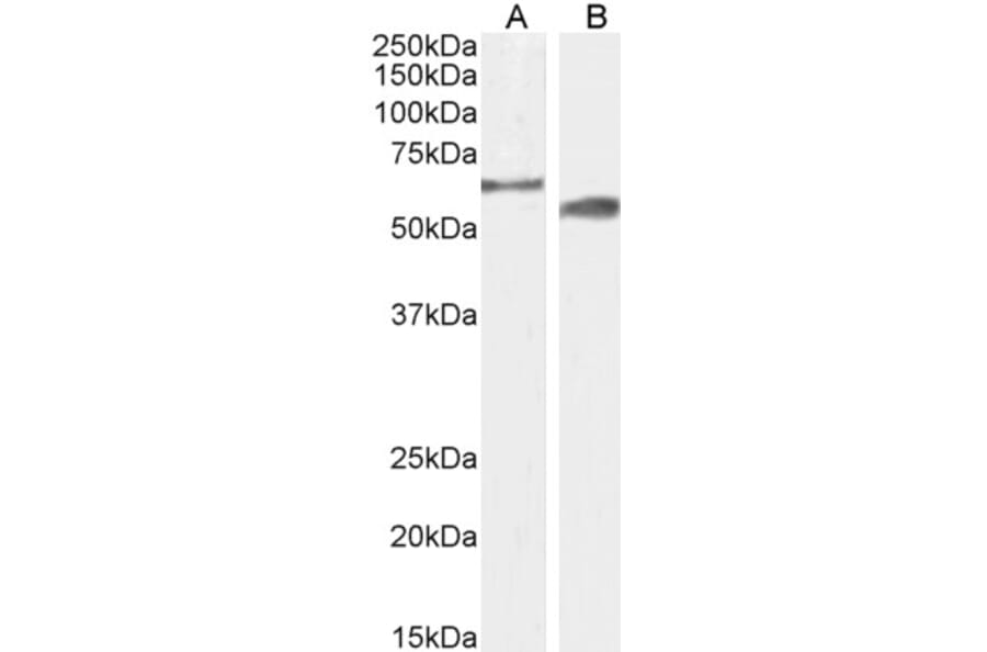 Western Blot - Anti-CYP2R1 Antibody (A85166) - Antibodies.com