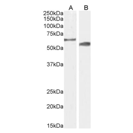 Western Blot - Anti-CYP2R1 Antibody (A85166) - Antibodies.com