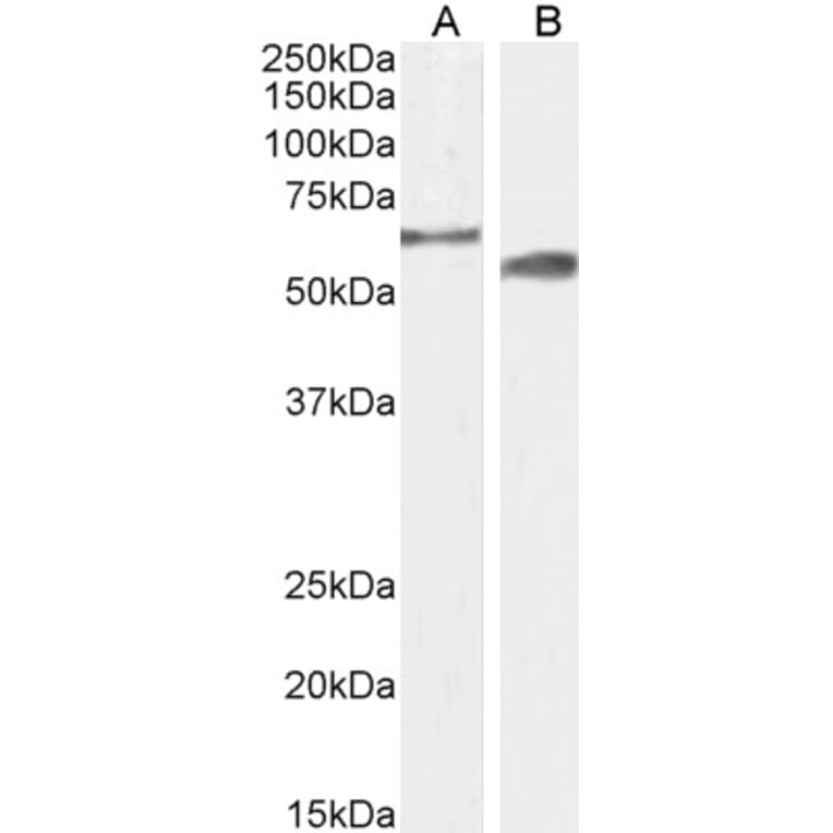 Western Blot - Anti-CYP2R1 Antibody (A85166) - Antibodies.com