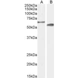 Western Blot - Anti-CYP2R1 Antibody (A85166) - Antibodies.com