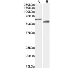 Western Blot - Anti-CYP2R1 Antibody (A85166) - Antibodies.com