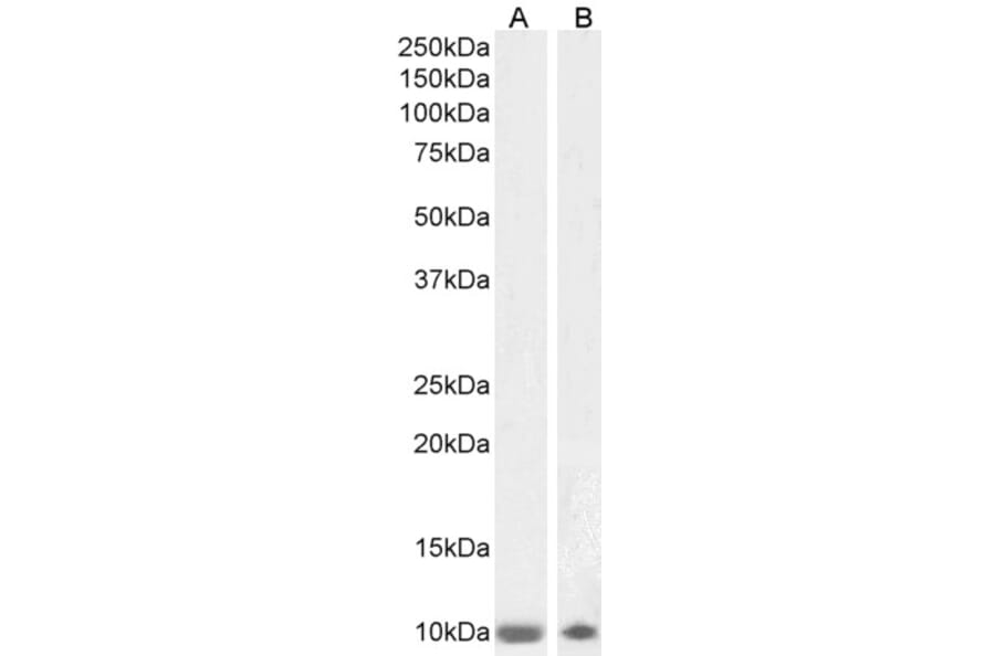 Western Blot - Anti-S100 beta Antibody (A85168) - Antibodies.com