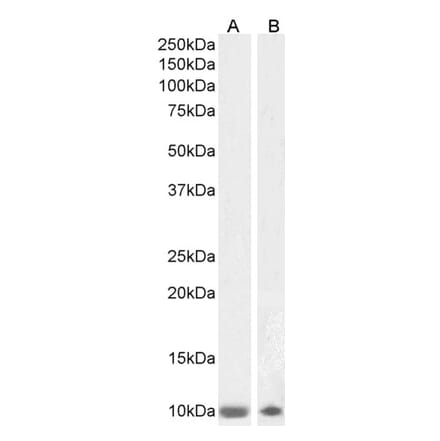 Western Blot - Anti-S100 beta Antibody (A85168) - Antibodies.com