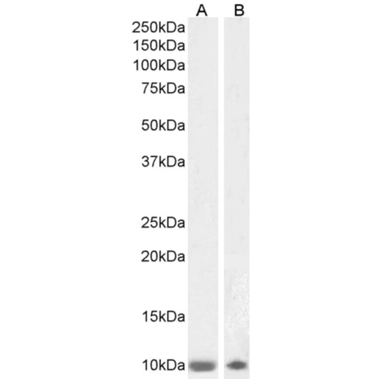 Western Blot - Anti-S100 beta Antibody (A85168) - Antibodies.com