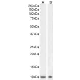 Western Blot - Anti-S100 beta Antibody (A85168) - Antibodies.com