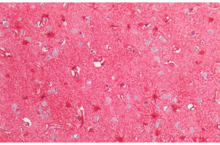 Immunohistochemistry - Anti-S100 beta Antibody (A85168) - Antibodies.com
