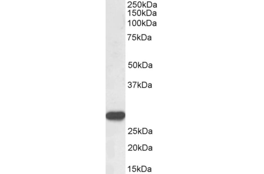 Western Blot - Anti-PR3 Antibody (A85169) - Antibodies.com