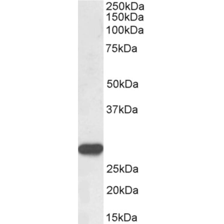 Western Blot - Anti-PR3 Antibody (A85169) - Antibodies.com