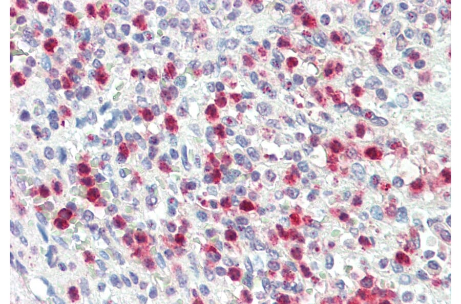 Immunohistochemistry - Anti-PR3 Antibody (A85169) - Antibodies.com