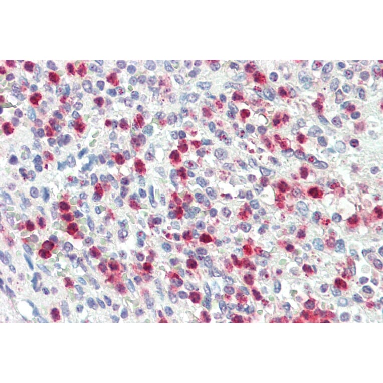 Immunohistochemistry - Anti-PR3 Antibody (A85169) - Antibodies.com