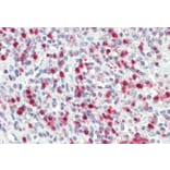 Immunohistochemistry - Anti-PR3 Antibody (A85169) - Antibodies.com