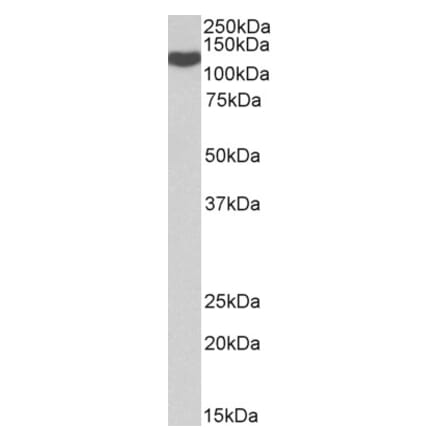 Western Blot - Anti-ADAM19 Antibody (A85170) - Antibodies.com