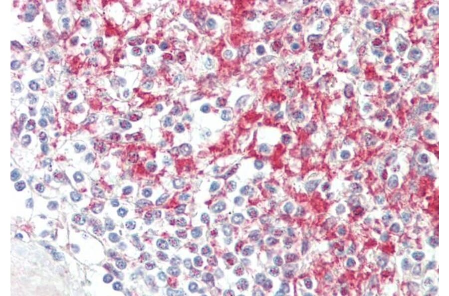 Immunohistochemistry - Anti-ADAM19 Antibody (A85170) - Antibodies.com