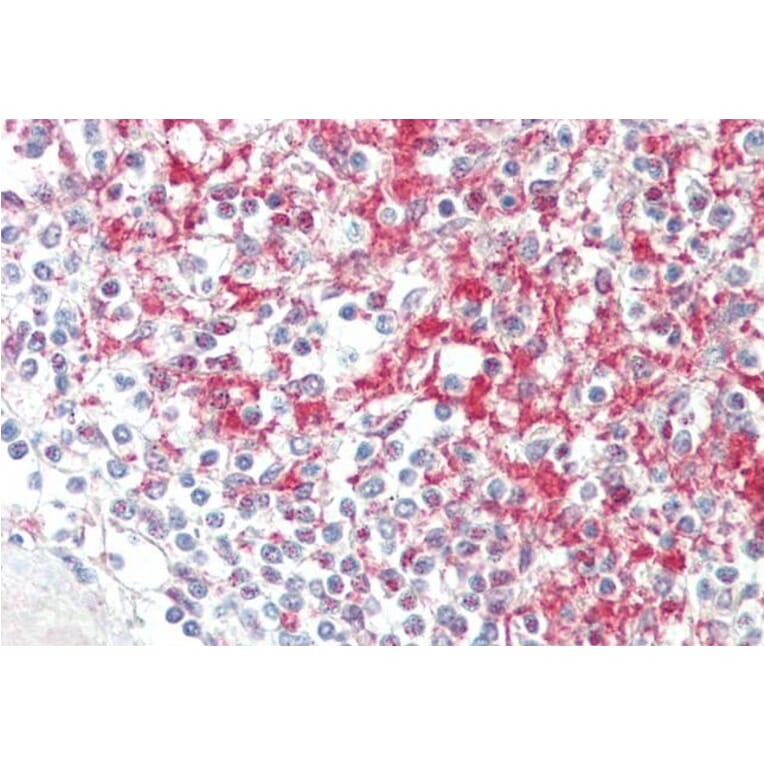 Immunohistochemistry - Anti-ADAM19 Antibody (A85170) - Antibodies.com