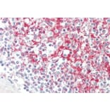 Immunohistochemistry - Anti-ADAM19 Antibody (A85170) - Antibodies.com