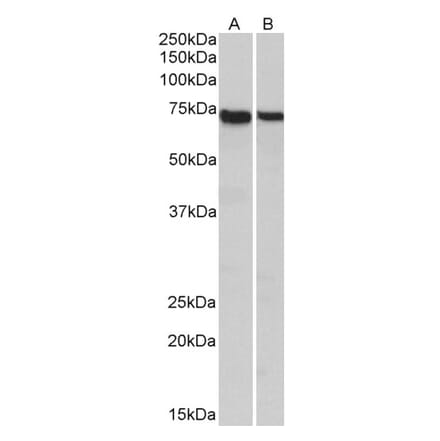 Western Blot - Anti-Munc18c Antibody (A85172) - Antibodies.com