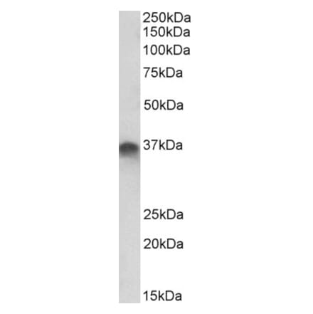 Western Blot - Anti-STX11 Antibody (A85174) - Antibodies.com