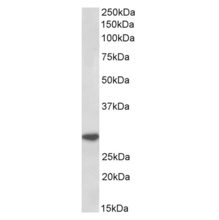 Western Blot - Anti-IL-1 beta Antibody (A85175) - Antibodies.com