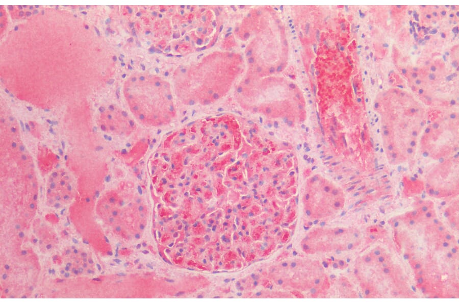 Immunohistochemistry - Anti-alpha 1 Fetoprotein Antibody (A85176) - Antibodies.com
