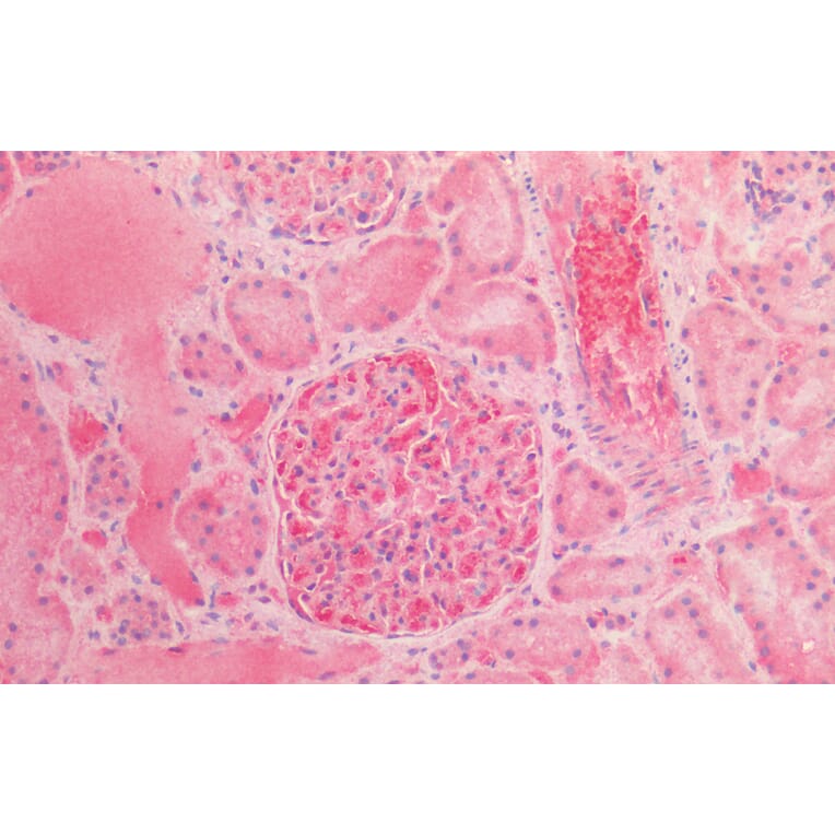Immunohistochemistry - Anti-alpha 1 Fetoprotein Antibody (A85176) - Antibodies.com