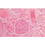 Immunohistochemistry - Anti-alpha 1 Fetoprotein Antibody (A85176) - Antibodies.com