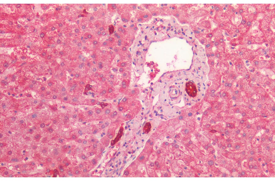 Immunohistochemistry - Anti-Cytokeratin 19 Antibody (A85178) - Antibodies.com