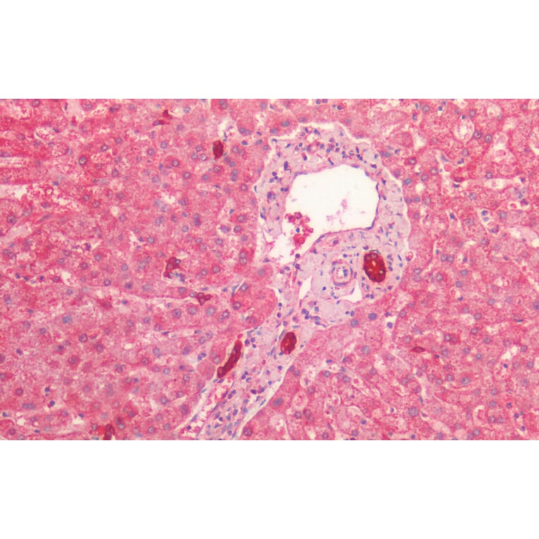 Immunohistochemistry - Anti-Cytokeratin 19 Antibody (A85178) - Antibodies.com