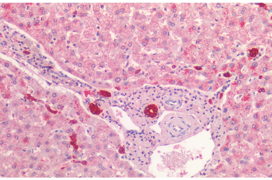 Immunohistochemistry - Anti-Cytokeratin 19 Antibody (A85180) - Antibodies.com