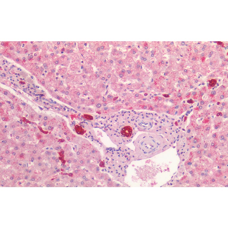 Immunohistochemistry - Anti-Cytokeratin 19 Antibody (A85180) - Antibodies.com