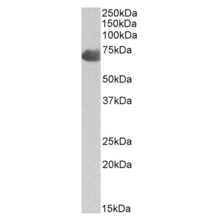 Western Blot - Anti-C9 Antibody (A85181) - Antibodies.com