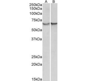 Western Blot - Anti-AACT Antibody (A85182) - Antibodies.com