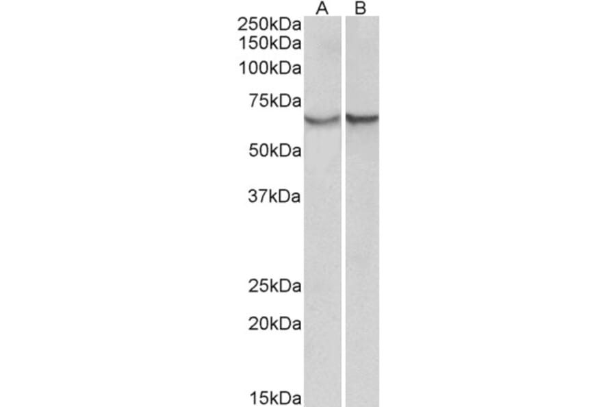 Western Blot - Anti-AACT Antibody (A85182) - Antibodies.com