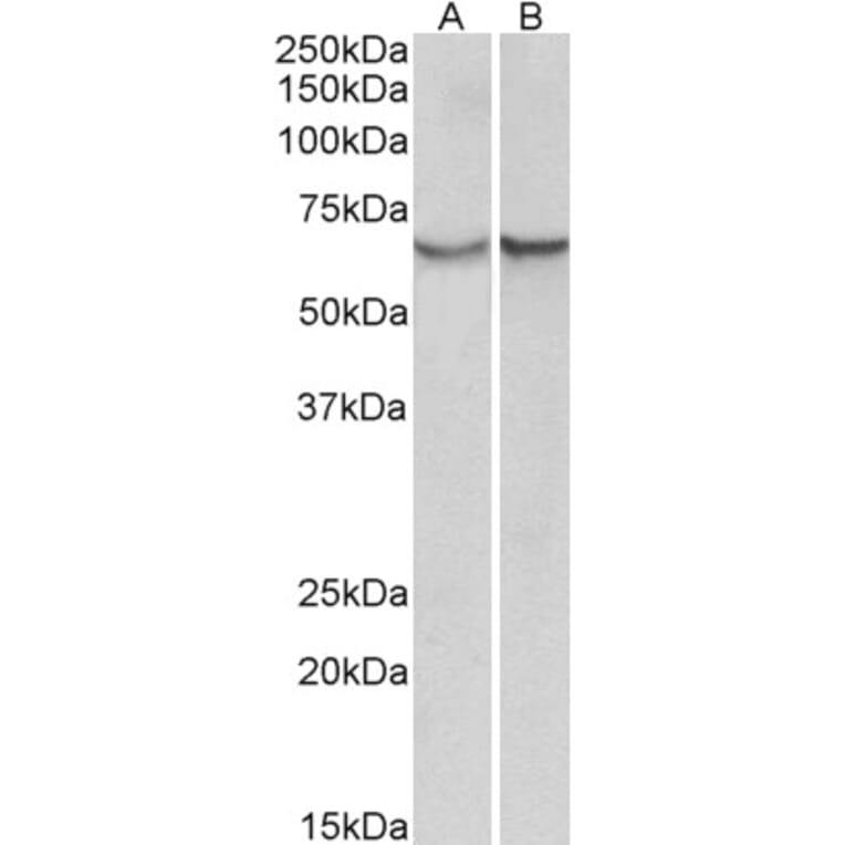 Western Blot - Anti-AACT Antibody (A85182) - Antibodies.com