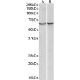 Western Blot - Anti-AACT Antibody (A85182) - Antibodies.com
