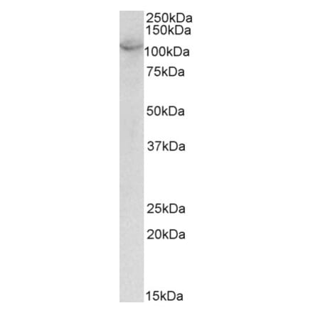 Western Blot - Anti-OAS3 Antibody (A85184) - Antibodies.com