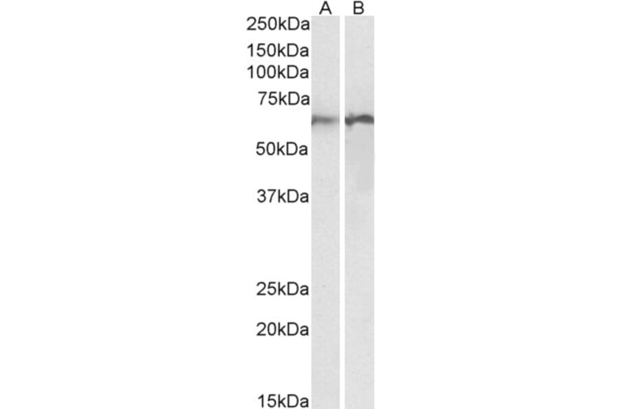 Western Blot - Anti-Calreticulin Antibody (A85185) - Antibodies.com