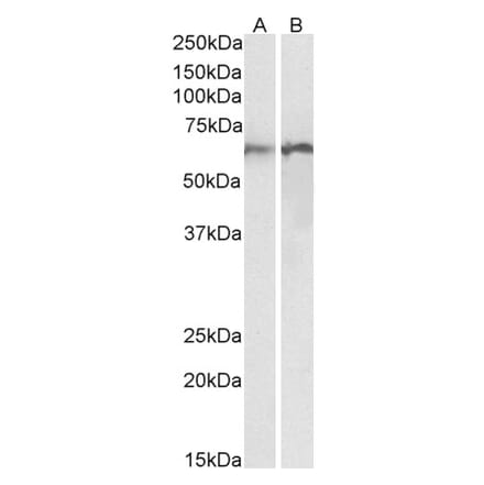 Western Blot - Anti-Calreticulin Antibody (A85185) - Antibodies.com