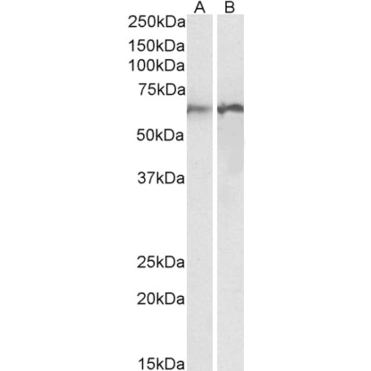 Western Blot - Anti-Calreticulin Antibody (A85185) - Antibodies.com