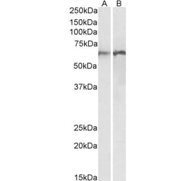 Western Blot - Anti-CALR Antibody (A85185) - Antibodies.com