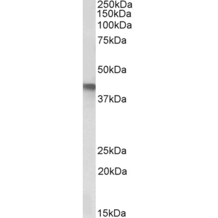 Western Blot - Anti-SERPINB1 Antibody (A85187) - Antibodies.com