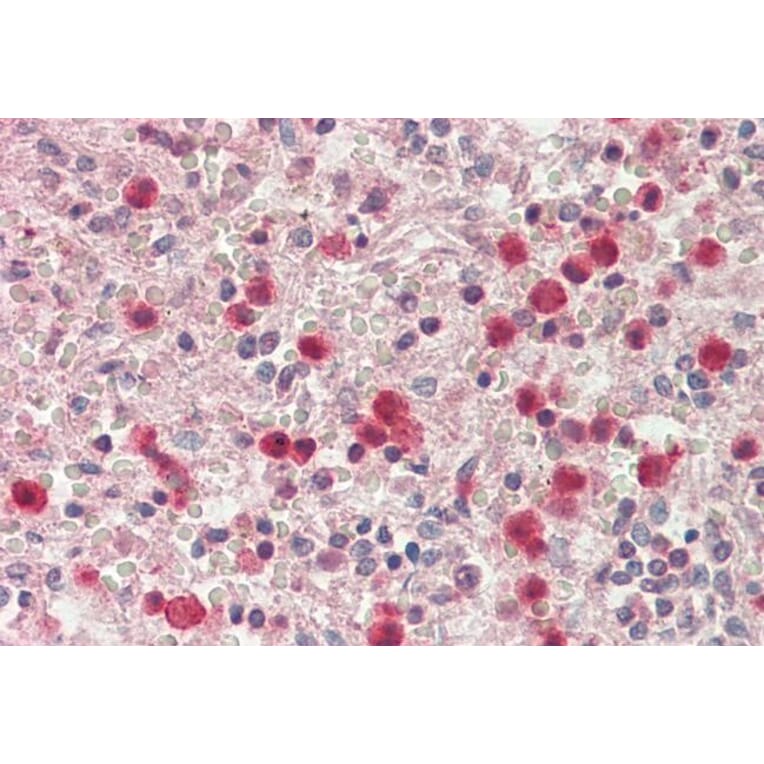 Immunohistochemistry - Anti-SERPINB1 Antibody (A85187) - Antibodies.com