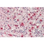 Immunohistochemistry - Anti-SERPINB1 Antibody (A85187) - Antibodies.com