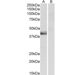 Western Blot - Anti-SERPINB1 Antibody (A85188) - Antibodies.com