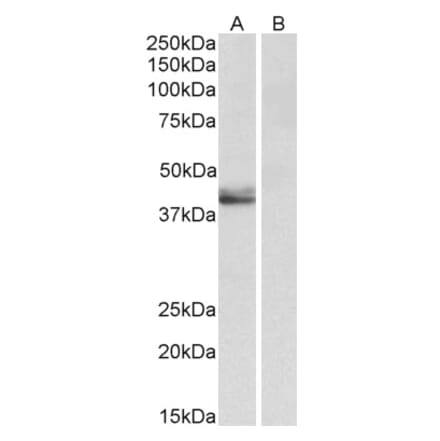 Western Blot - Anti-SERPINB1 Antibody (A85188) - Antibodies.com