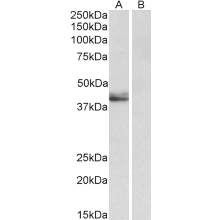 Western Blot - Anti-SERPINB1 Antibody (A85188) - Antibodies.com