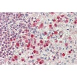 Immunohistochemistry - Anti-SERPINB1 Antibody (A85188) - Antibodies.com